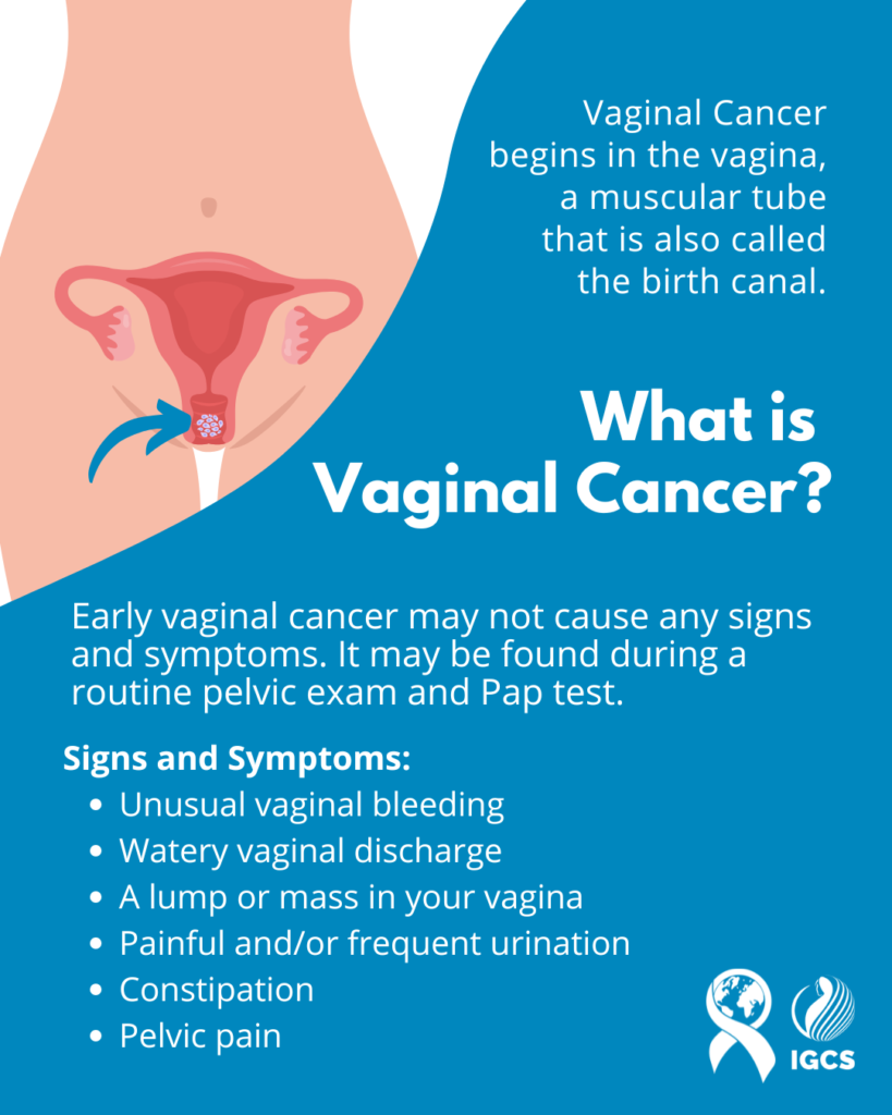 What is Vaginal Cancer