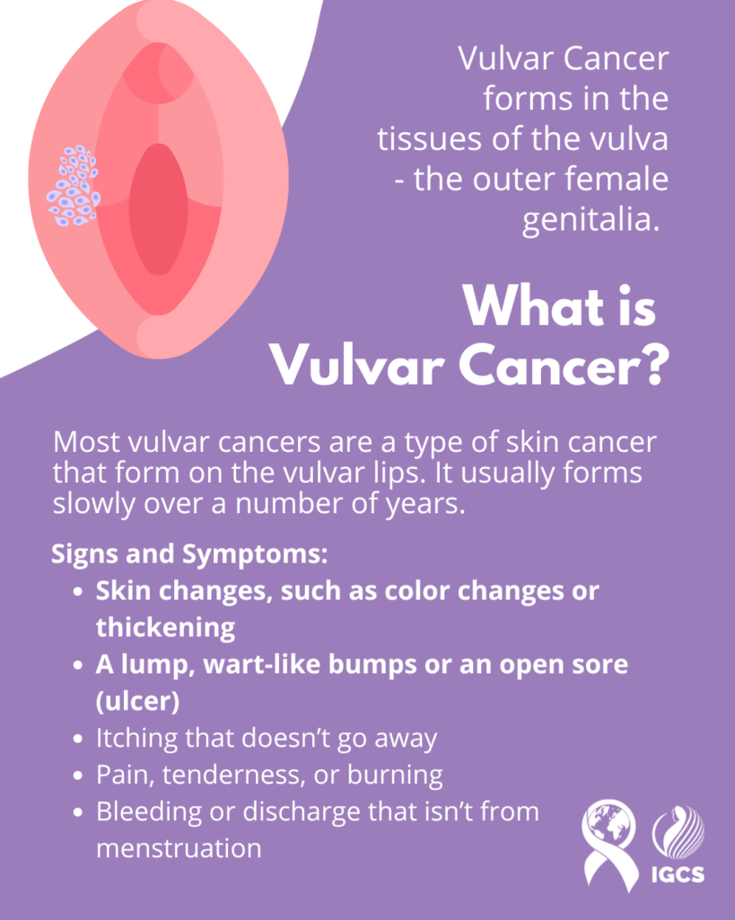 What is Vulvar Cancer