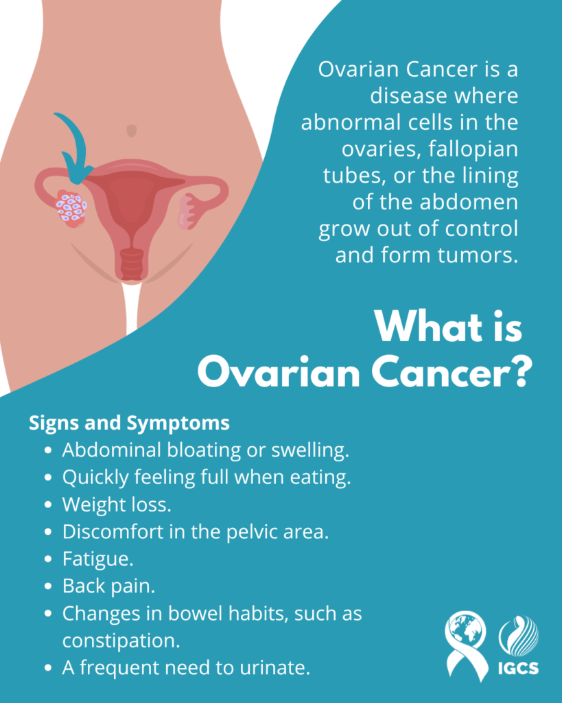 What is ovarian Cancer