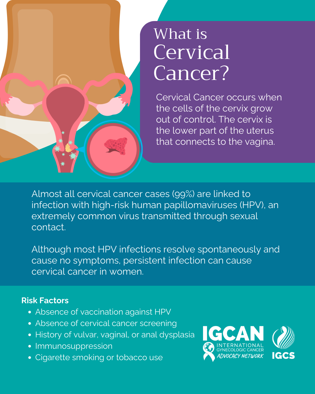 What is Cervical Cancer